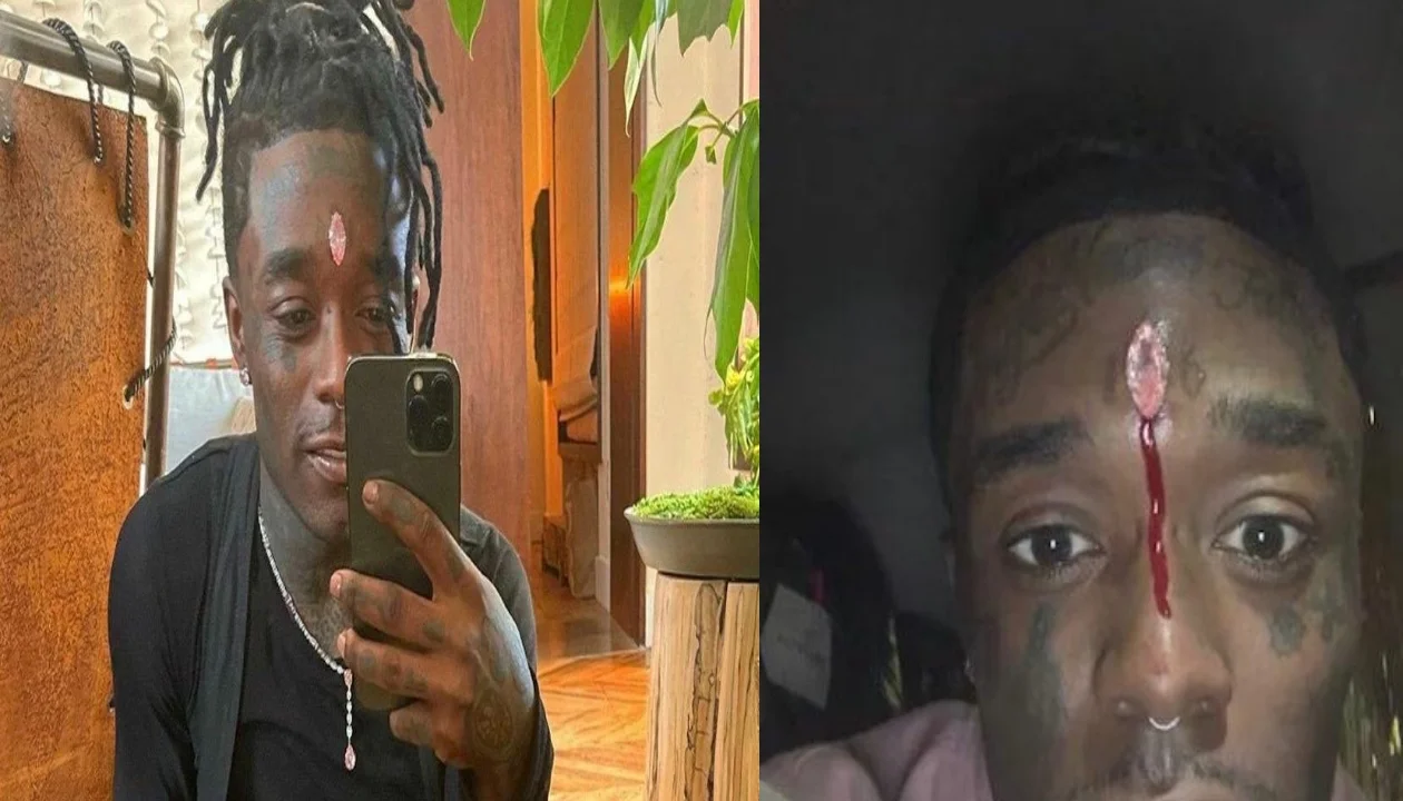 A fan ripped rapper lil uzi vert forehead diamond worth 175 crores