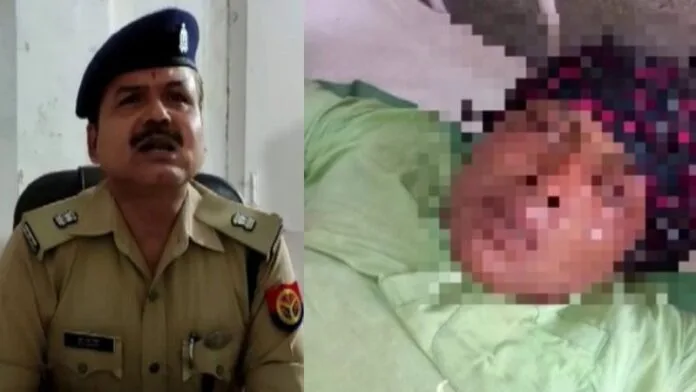 Transgender chop tailors genitals in shamli