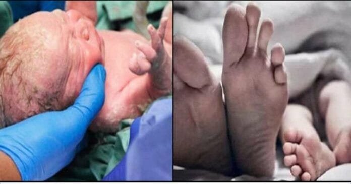 With the help of YouTube video, 15-year-old girl gave birth to a baby girl at home With the help of YouTube video, 15-year-old girl gave birth to a baby girl at home