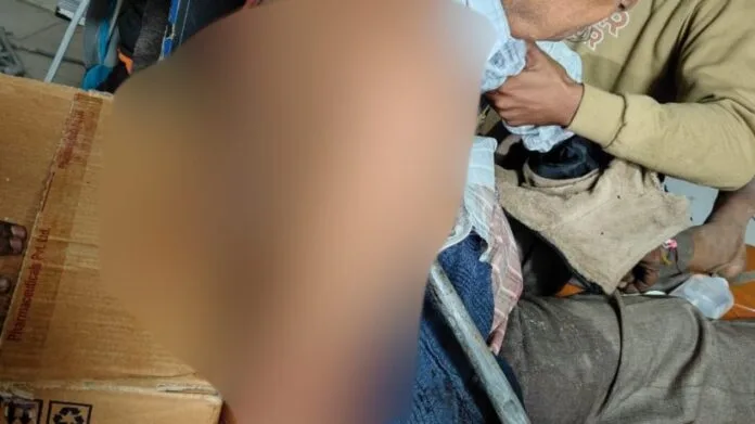 Iron rod passed through the chest of the passenger: Heart safe, bar cut into 2 pieces; In Kanpur, 6 doctors evacuated in 2 hours